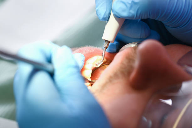 Best Emergency Tooth Extraction  in Duvall, WA
