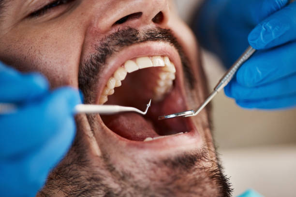 Best Knocked-Out Tooth Emergency  in Duvall, WA